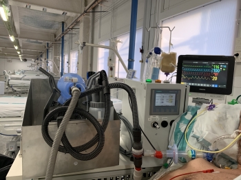 prototipo respirador leitat_1